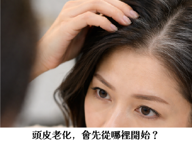 頭皮老化，會先從哪裡開始？